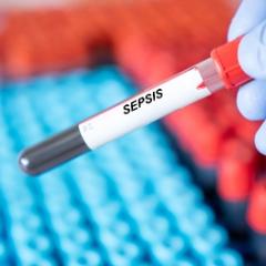 A blood vial labelled with the word sepsis being held by a gloved hand 